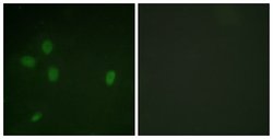 Phospho-53BP1 (Ser25) Polyclonal Antibody, Invitrogen 100 &mu;g; Unconjugated:Antibodies,