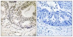 Phospho-53BP1 (Ser25) Polyclonal Antibody, Invitrogen 100 &mu;g; Unconjugated:Antibodies,