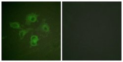 Phospho-EphB1/EphB2 (Tyr594, Tyr604) Polyclonal Antibody, Invitrogen 100