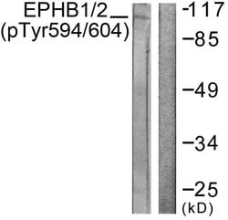 Phospho-EphB1/EphB2 (Tyr594, Tyr604) Polyclonal Antibody, Invitrogen 100