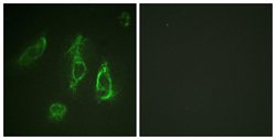 EpoR Polyclonal Antibody, Invitrogen 100 &mu;g; Unconjugated:Antibodies,