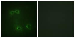 Phospho-FAS (Tyr291) Polyclonal Antibody, Invitrogen™