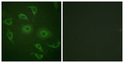 IFNAR1 Polyclonal Antibody, Invitrogen 100 μg; Unconjugated:Antibodies,