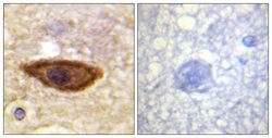 IFNAR1 Polyclonal Antibody, Invitrogen 100 μg; Unconjugated:Antibodies,