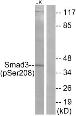 Phospho-SMAD3 (Ser208) Polyclonal Antibody, Invitrogen 100 &mu;g | Buy Online | Invitrogen | Fisher Scientific