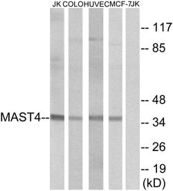 MAST4 Polyclonal Antibody, Invitrogen 100 &mu;g | Buy Online | Invitrogen | Fisher Scientific