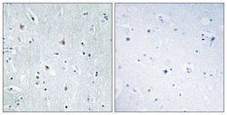 SOX12 Polyclonal Antibody, Invitrogen 100 &mu;g | Buy Online | Invitrogen | Fisher Scientific