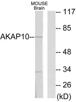 AKAP10 Polyclonal Antibody, Invitrogen 100 &mu;g | Buy Online | Invitrogen | Fisher Scientific