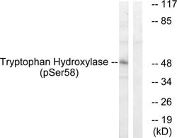 Phospho-TPH1 (Ser58) Polyclonal Antibody, Invitrogen 100 &mu;g | Buy Online | Invitrogen | Fisher Scientific