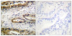 Invitrogen Phospho-VEGF Receptor 2 (Tyr1054) Polyclonal Antibody, Invitrogen™