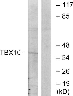 TBX10 Polyclonal Antibody, Invitrogen 100 &mu;g; Unconjugated:Antibodies,