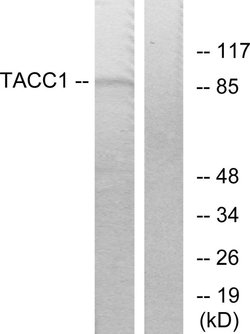TACC1 Polyclonal Antibody, Invitrogen 100 &mu;g; Unconjugated:Antibodies