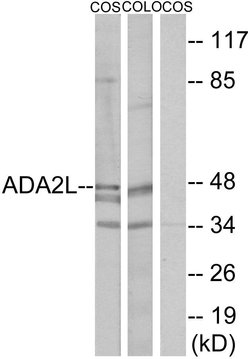 TADA2L Polyclonal Antibody, Invitrogen 100 &mu;g | Buy Online | Invitrogen | Fisher Scientific