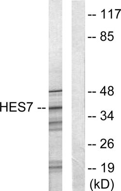 HEXIM1 Polyclonal Antibody, Invitrogen 100 &mu;g; Unconjugated:Antibodies,