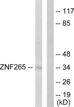 ZRANB2 Polyclonal Antibody, Invitrogen 100 &mu;g; Unconjugated:Antibodies,