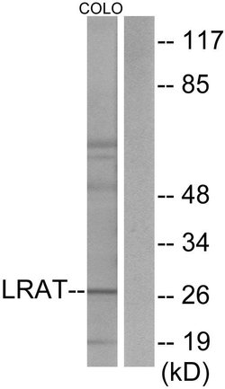 LRAT Polyclonal Antibody, Invitrogen 100 &mu;g | Buy Online | Invitrogen | Fisher Scientific