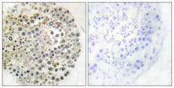 TRIM16 Polyclonal Antibody, Invitrogen 100 &mu;g; Unconjugated:Antibodies,