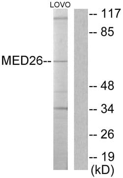MED26 Polyclonal Antibody, Invitrogen 100 &mu;g; Unconjugated:Antibodies,