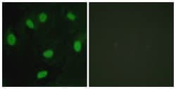 TBX15/TBX18 Polyclonal Antibody, Invitrogen 100 &mu;g; Unconjugated:Antibodies,