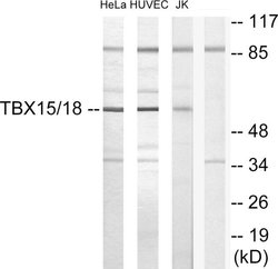 TBX15/TBX18 Polyclonal Antibody, Invitrogen 100 &mu;g; Unconjugated:Antibodies,