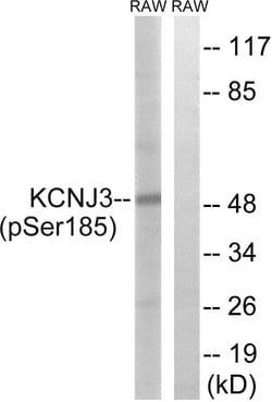 Phospho-Kir3.1 (Ser185) Polyclonal Antibody, Invitrogen 100 &mu;g; Unconjugated:Antibodies,