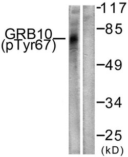 Phospho-GRB10 (Tyr67) Polyclonal Antibody, Invitrogen 100 &mu;g; Unconjugated:Antibodies,