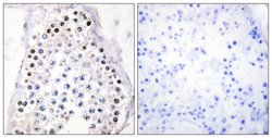 HOXA1/HOXB1/HOXD1 Polyclonal Antibody, Invitrogen 100 &mu;g; Unconjugated:Antibodies,