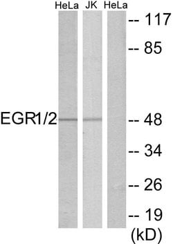 EGR1/EGR2 Polyclonal Antibody, Invitrogen 100 &mu;g; Unconjugated:Antibodies,