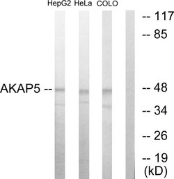 AKAP5 Polyclonal Antibody, Invitrogen 100 &mu;g; Unconjugated:Antibodies,