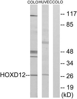 HOXD12 Polyclonal Antibody, Invitrogen 100 &mu;g; Unconjugated:Antibodies,