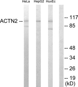 alpha Actinin 2/3 Polyclonal Antibody, Invitrogen 100 &mu;g; Unconjugated:Antibodies,