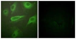Invitrogen Phospho-IL4R (Tyr497) Polyclonal Antibody 100 &mu;g; Unconjugated:Antibodies,