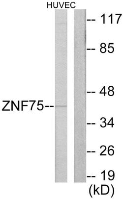 ZNF75D Polyclonal Antibody, Invitrogen 100 &mu;g; Unconjugated:Antibodies,