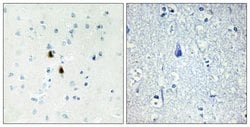 Invitrogen PKIA Polyclonal Antibody 100 &mu;g; Unconjugated:Antibodies,