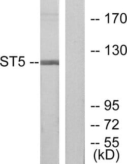 ST5 Polyclonal Antibody, Invitrogen 100 &mu;g; Unconjugated:Antibodies,