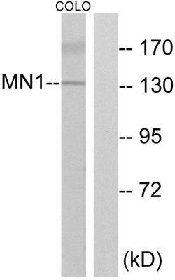 MN1 Polyclonal Antibody, Invitrogen 100 &mu;g | Buy Online | Invitrogen | Fisher Scientific