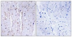 AKAP13 Polyclonal Antibody, Invitrogen 100 &mu;g; Unconjugated:Antibodies,
