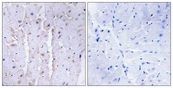 AKAP13 Polyclonal Antibody, Invitrogen&trade; 100 &mu;g; Unconjugated 