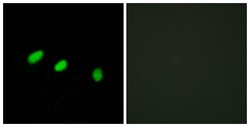 TRA2A Polyclonal Antibody, Invitrogen 100 μg; Unconjugated:Antibodies,