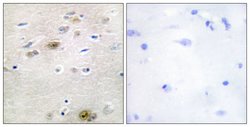 TRA2A Polyclonal Antibody, Invitrogen 100 μg; Unconjugated:Antibodies,