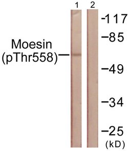 Phospho-Ezrin/Radixin/Moesin (Thr558) Polyclonal Antibody, Invitrogen 100