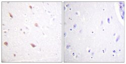 Phospho-NIFK (Thr234) Polyclonal Antibody, Invitrogen 100 &mu;g | Buy Online | Invitrogen | Fisher Scientific