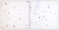NIFK Polyclonal Antibody, Invitrogen 100 &mu;g | Buy Online | Invitrogen | Fisher Scientific