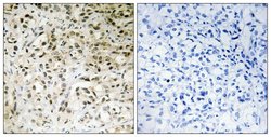 TAF5 Polyclonal Antibody, Invitrogen 100 μg; Unconjugated:Antibodies,
