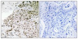 TAF13 Polyclonal Antibody, Invitrogen 100 &mu;g; Unconjugated:Antibodies,