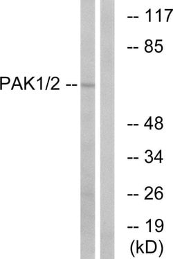 PAK1/PAK2 Polyclonal Antibody, Invitrogen 100 &mu;g; Unconjugated:Antibodies,