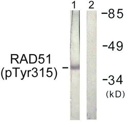 Invitrogen Phospho-RAD51 (Tyr315) Polyclonal Antibody 100 &mu;g | Buy Online | Invitrogen&trade; | Fisher Scientific