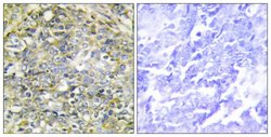 UBXD5 Polyclonal Antibody, Invitrogen 100 μg; Unconjugated:Antibodies,