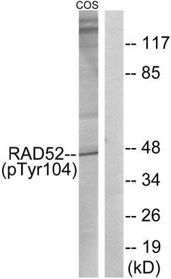 Phospho-RAD52 (Tyr104) Polyclonal Antibody, Invitrogen 100 &mu;g; Unconjugated:Antibodies,