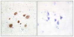 PNCK Polyclonal Antibody, Invitrogen 100 &mu;g; Unconjugated:Antibodies,